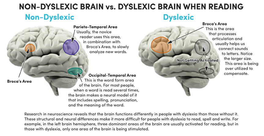 Dyslexic meaning